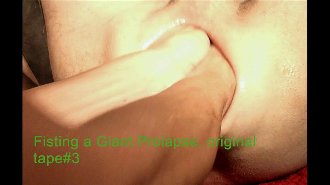 Fisting a Giant Prolapse, original tape #3