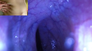 POV – The view staring up my descending colon as I mush you from the outside